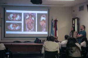 Un caso “raro dentro de las raras”: así se destapó el diagnóstico que desafió a dos servicios del Hospital Madariaga